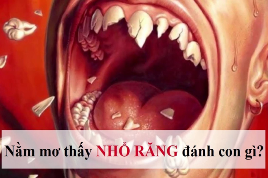 FC88 gợi ý số đề khi nằm mơ nhổ răng